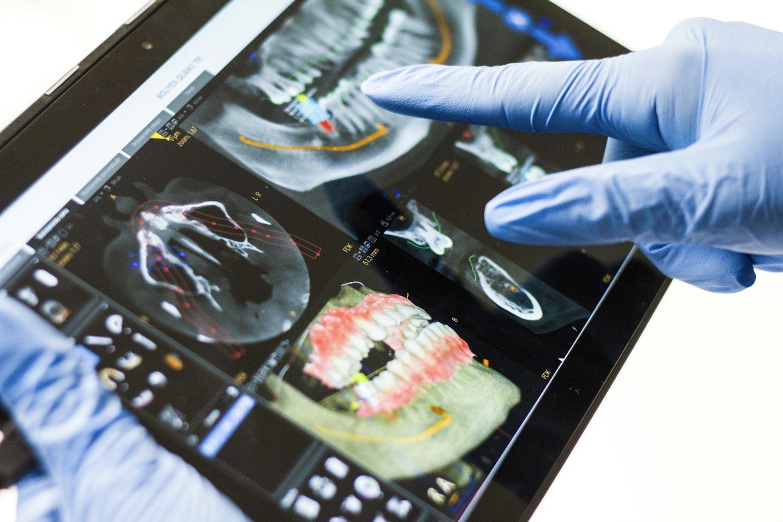 Digitaler Zahnscan auf einem Tablet