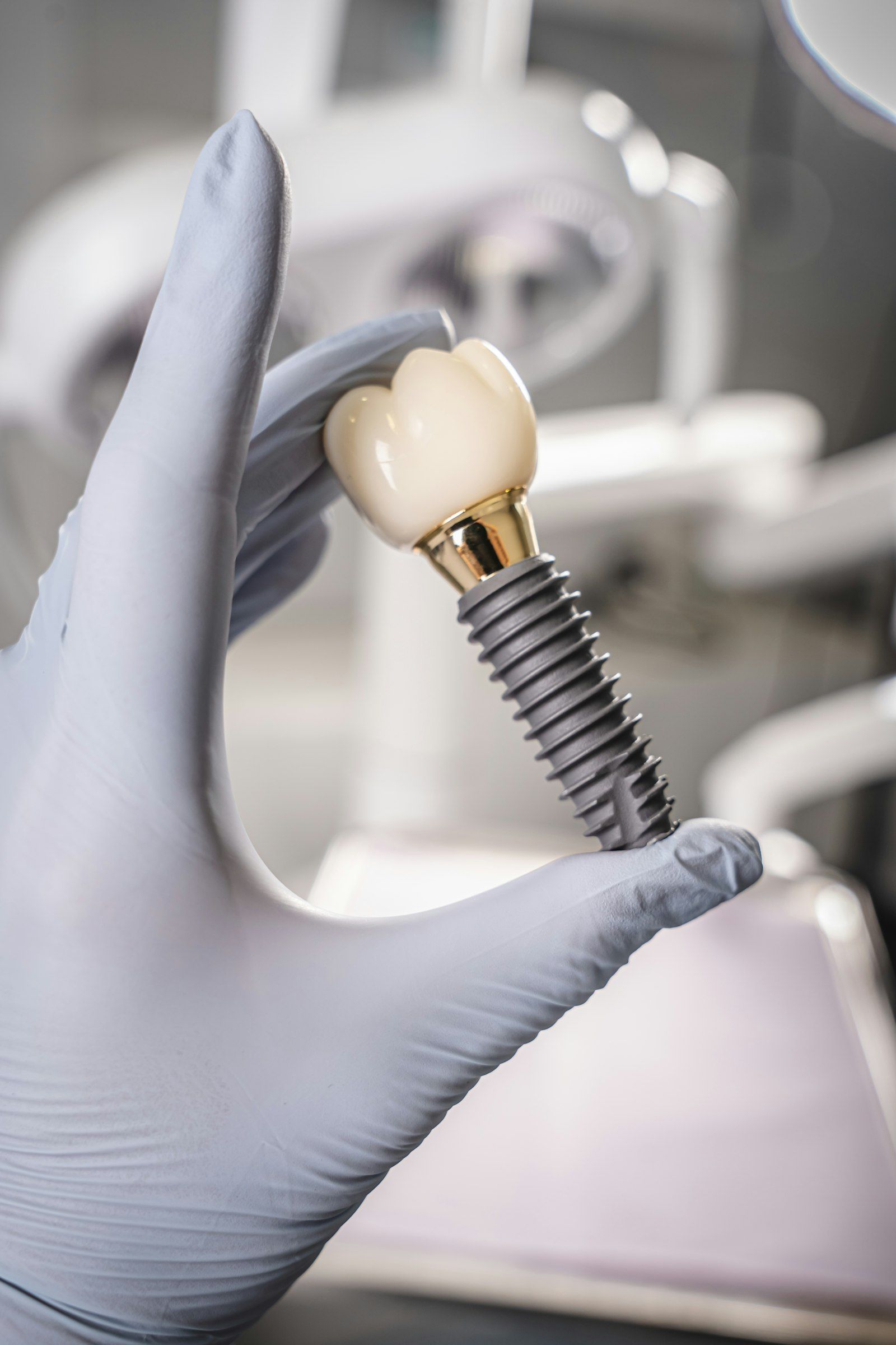 Implantat mit aufgeschraubter Krone